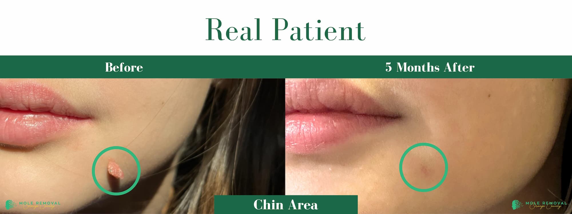 OC New before_after #12
