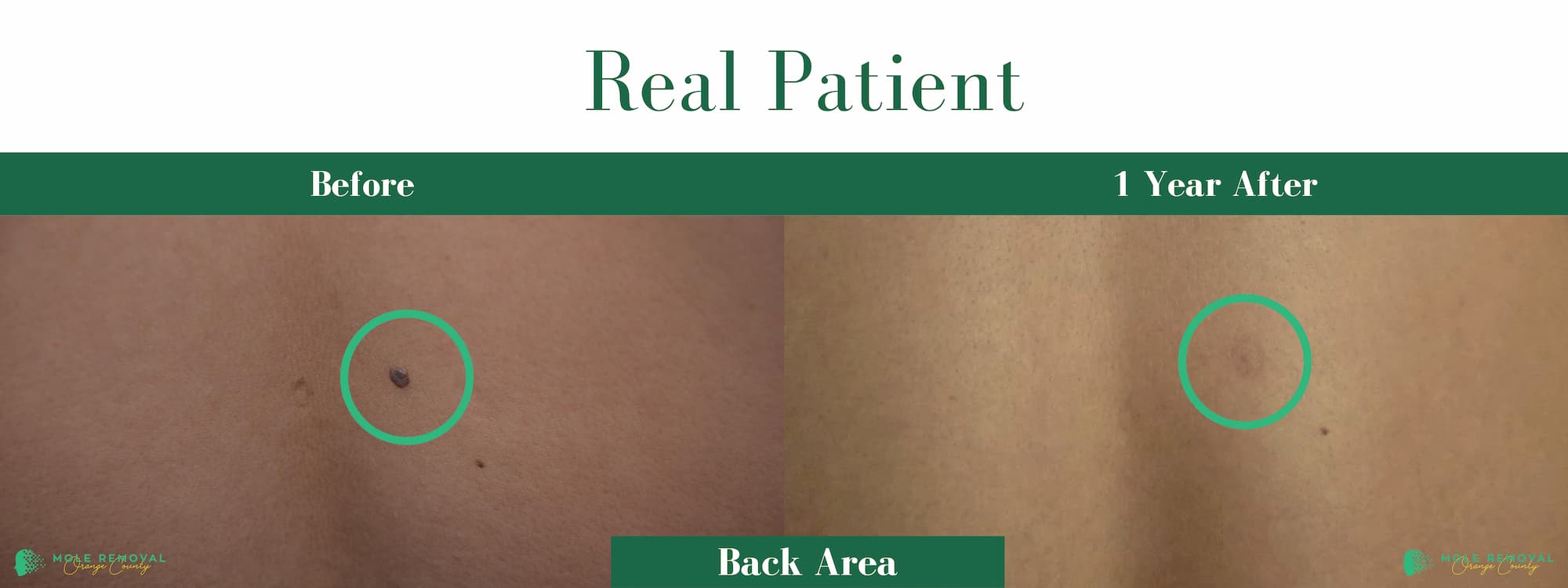 OC NEW BEFORE_AFTER PIC APRIL 26